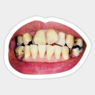 damaged teeth Sticker